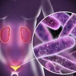 Causes and Risk Factors of UTIs