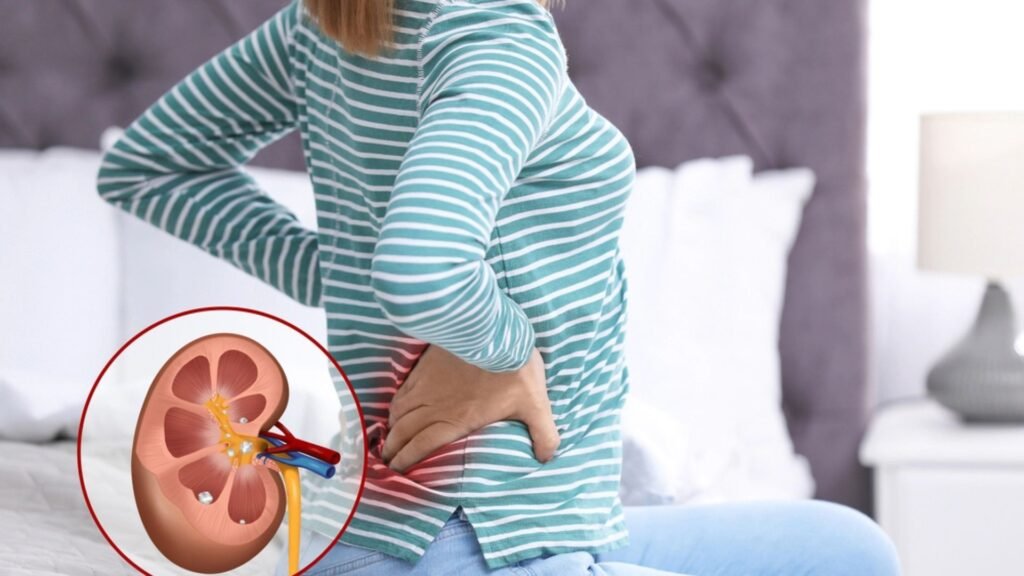 How to Manage Pain from Kidney Stones