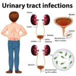 The Most Common Symptoms of a UTI and How to Identify Them