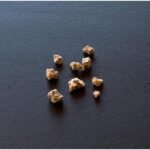 Recovery Tips After Kidney Stone Treatment