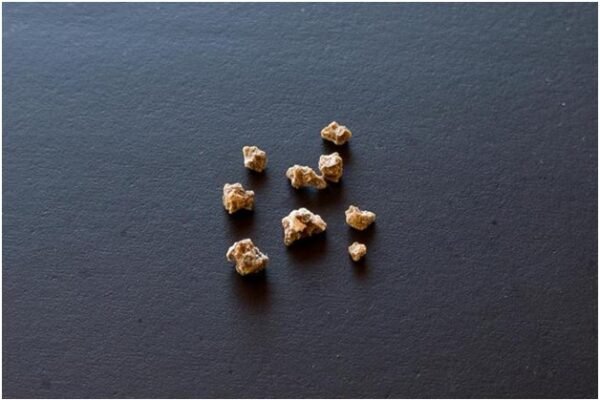 Recovery Tips After Kidney Stone Treatment