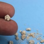 Risk Factors for Developing Kidney Stones