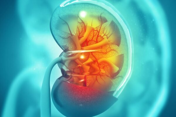 The Connection Between Kidney Stones and Hypertension