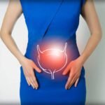 How Diet Impacts Bladder Health