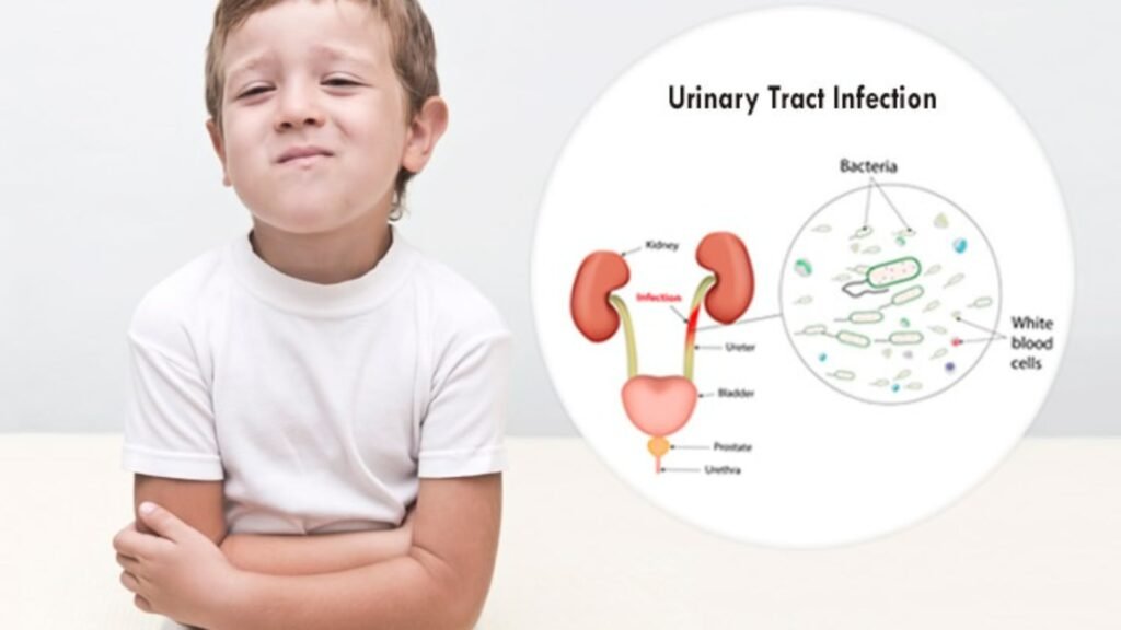 UTIs in Children: Causes, Symptoms, and Treatments