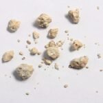 What Causes Kidney Stones and How to Prevent Them