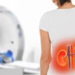 The Symptoms of Kidney Stones and How to Recognize Them