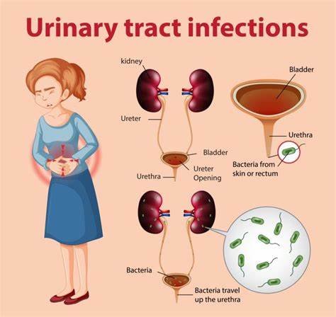 The Most Common Symptoms of a UTI and How to Identify Them