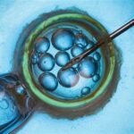 Male Infertility Treatment: New Innovations and Technologies
